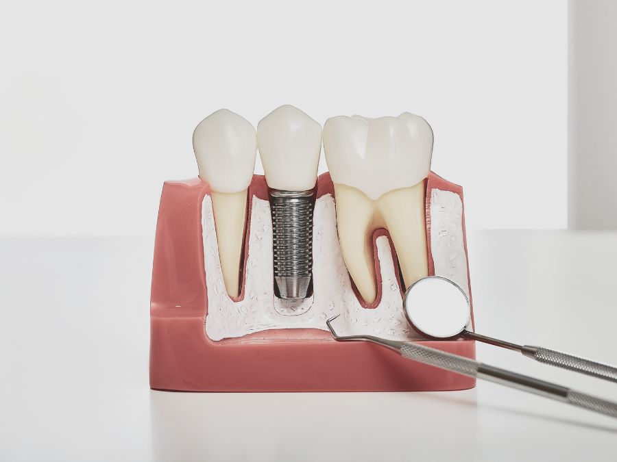 Oferta zdjęcia (2) Usługi stomatologiczne w Dental Medical Clinic